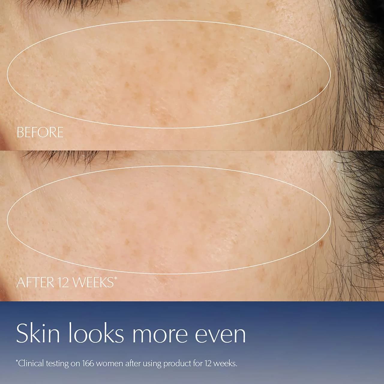 Estée Lauder  Advanced Night Repair Synchronized Multi-Recovery Complex Serum with Hyaluronic Acid 4