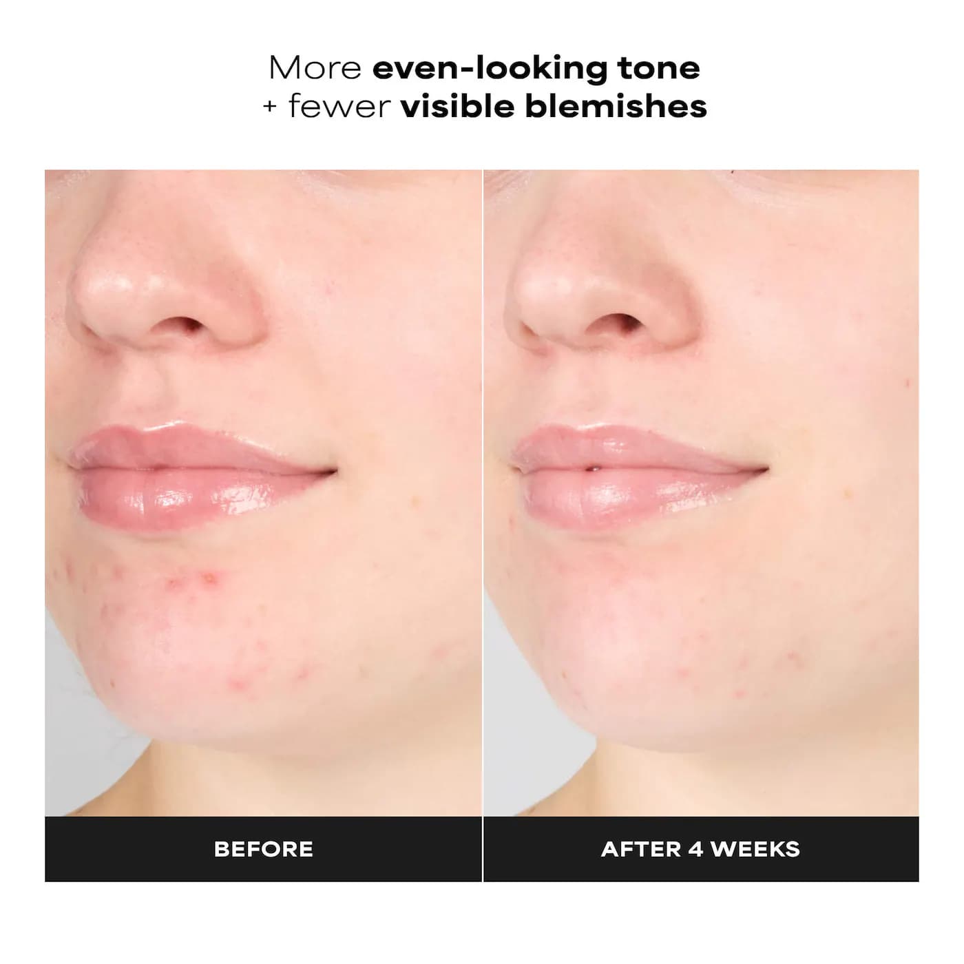 Paula's Choice  Skin Perfecting 1% BHA Gentle Exfoliating Gel Toner for Sensitive Skin 2